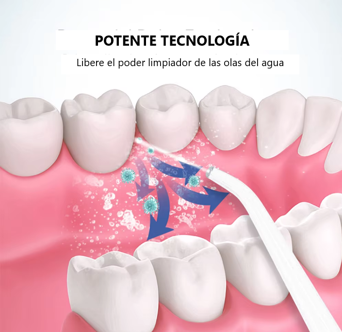 Irrigador Dental Fresh™